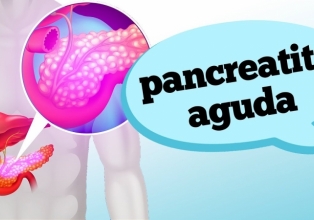 Pancreatite aguda: quando suspeitar dos sintomas?