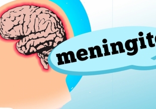 Meningite: saiba como identificar e prevenir