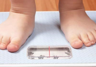 Obesidade infantil vai além de má alimentação
