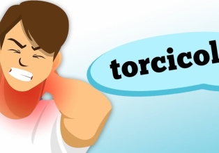 O que pode causar torcicolo?