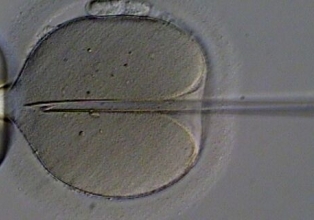 Mulheres que não possuem mais óvulos também podem engravidar por fertilização in vitro