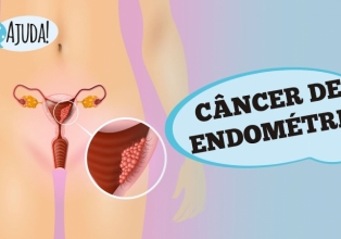 Fatores de risco para câncer de endométrio: