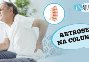 O que é artrose na coluna? Quando suspeitar e qual o tratamento?