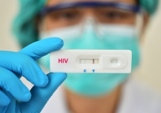 Saúde de Treze Tílias alerta para a importância da prevenção combinada para evitar a infecção pelo HIV