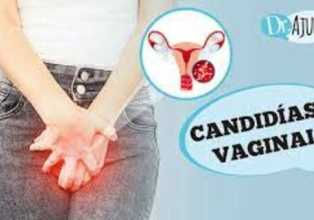 O que é candidíase vaginal?