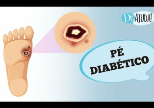 Pé diabético: prevenção e tratamento