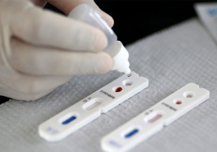 Testes de farmácia positivos para Covid tiveram aumento de 178% entre abril e maio em SC