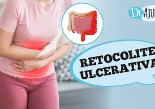 O que é retocolite ulcerativa? Quais os sintomas e o tratamento?