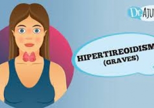 Hipertireoidismo e doença de graves: quais os sintomas e tratamento