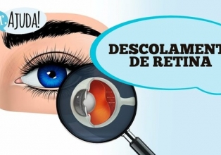 Descolamento de retina: Fique atento!