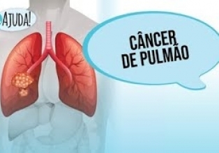 Câncer de pulmão é um dos mais comuns no Brasil